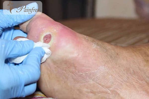 آیا ماساژ برای دیابت ایمن است؟